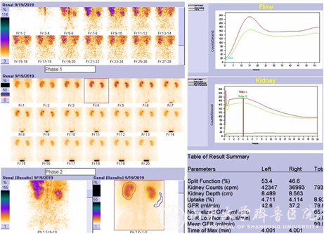 核医学科引进全球先进西门子Intevo 16 SPECT/CT新机器